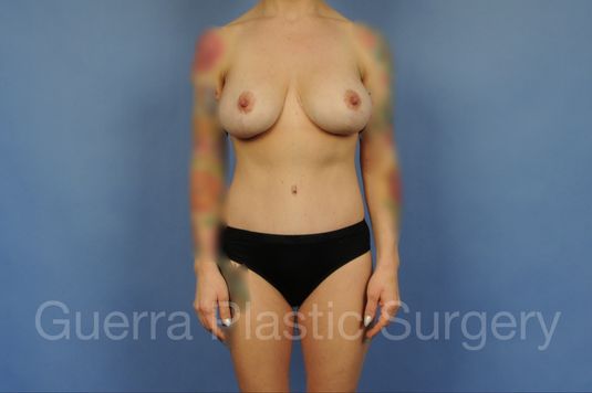 prev Case #28084 After