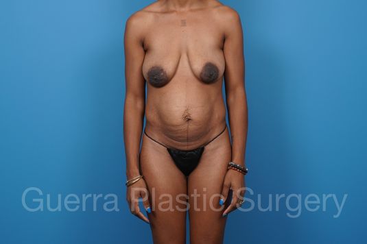 prev Case #40413 Before