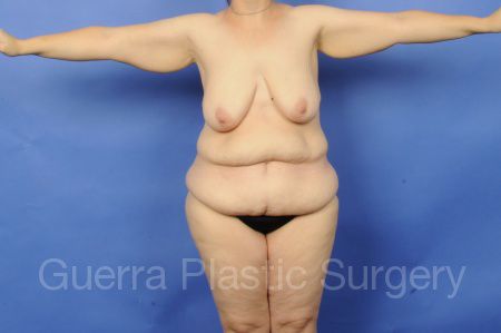 prev Case #28060 Before