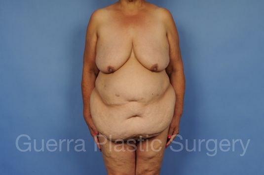 prev Case #28080 Before