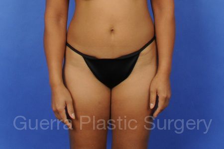 prev Case #274 Before