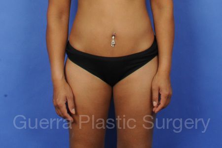 prev Case #274 After