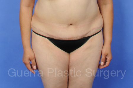 next Case #5284 Before