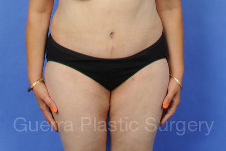 next Case #5284 After