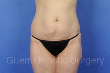 prev Case #5762 Before