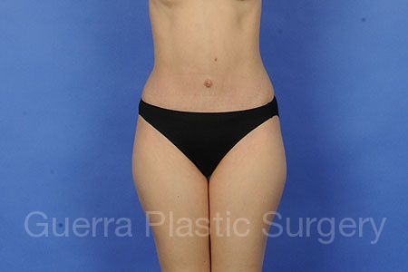 next Case #6612 After