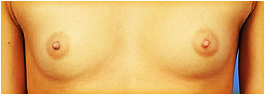 desire fuller breasts photo